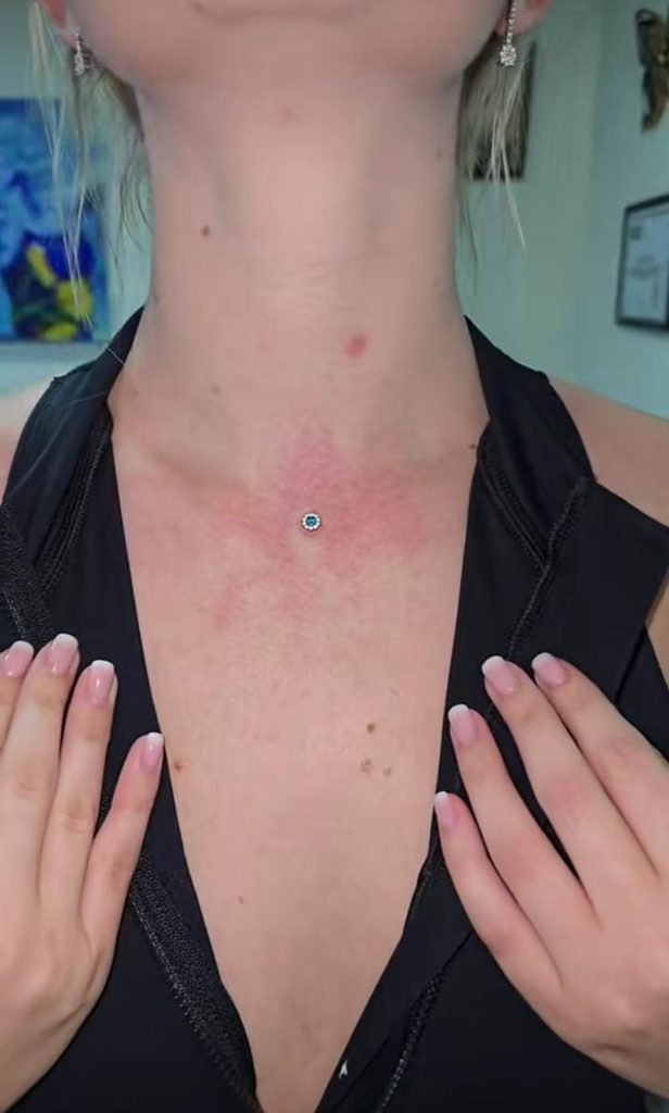 15 Stunning Neck Piercing Ideas Worth Trying Today 7 Microdermal Neck Piercing Constellation